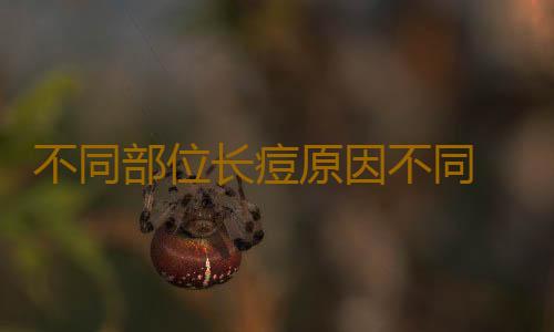不同部位长痘原因不同 视而不见会加重你的问题