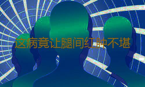 这病竟让腿间红肿不堪