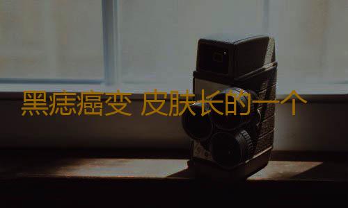 黑痣癌变 皮肤长的一个黑点竟害她活不长